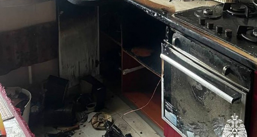 Пострадавшую на пожаре в Вологодской области женщину госпитализировали в больницу