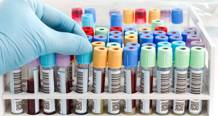 Мобильные пункты тестирования на ВИЧ выходят на улицы Вологды и Череповца