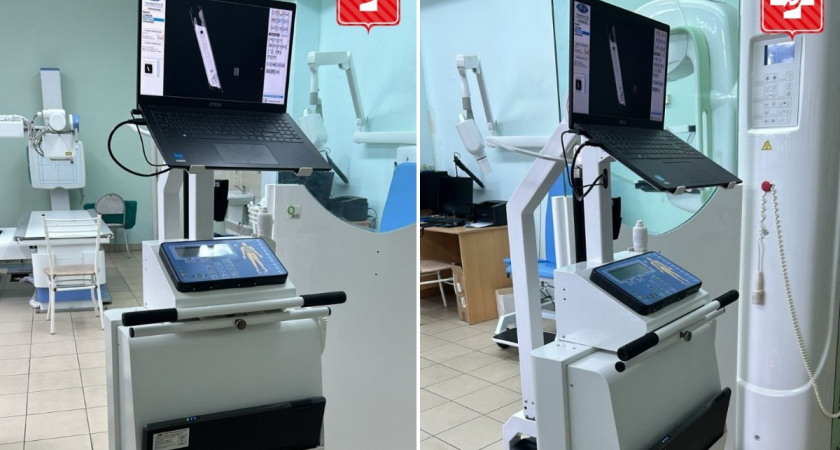 В одну из больниц Вологодской области поступил новый передвижной рентген-аппарат