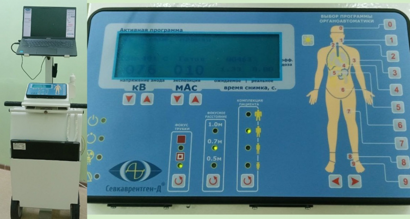 Новый цифровой рентген для тяжелобольных пациентов появился в Вологодской области