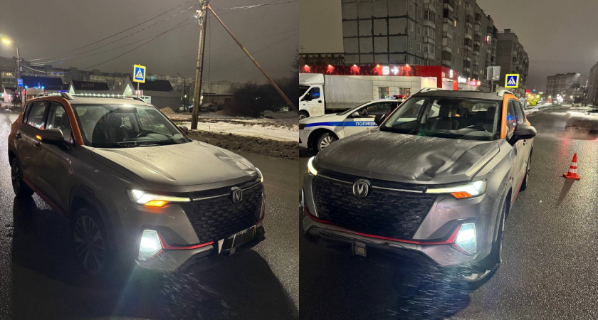 Пенсионерка попала под колёса автомобиля в Вологодской области и была экстренно госпитализирована